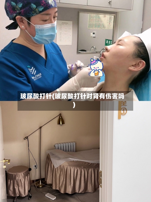 玻尿酸打针(玻尿酸打针对肾有伤害吗)-第2张图片