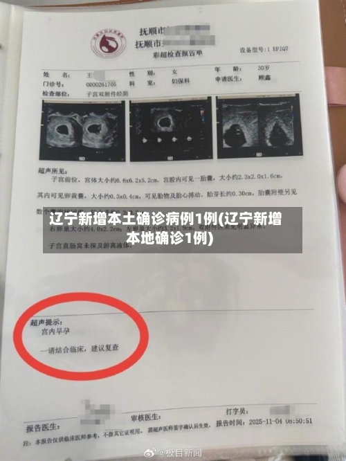 辽宁新增本土确诊病例1例(辽宁新增本地确诊1例)-第1张图片