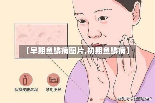 【早期鱼鳞病图片,初期鱼鳞病】-第2张图片